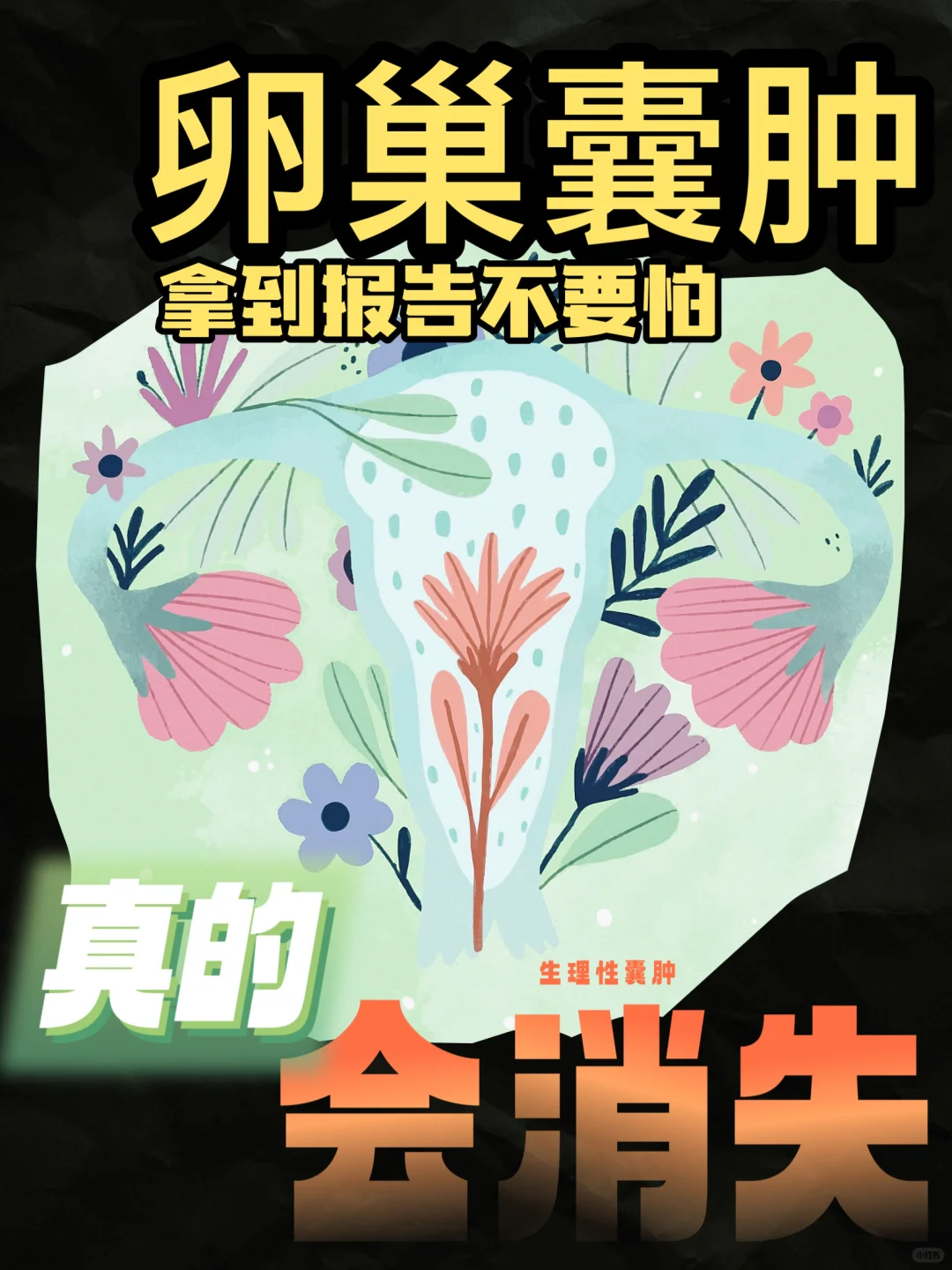 探究卵巢囊肿的消失可能与调养