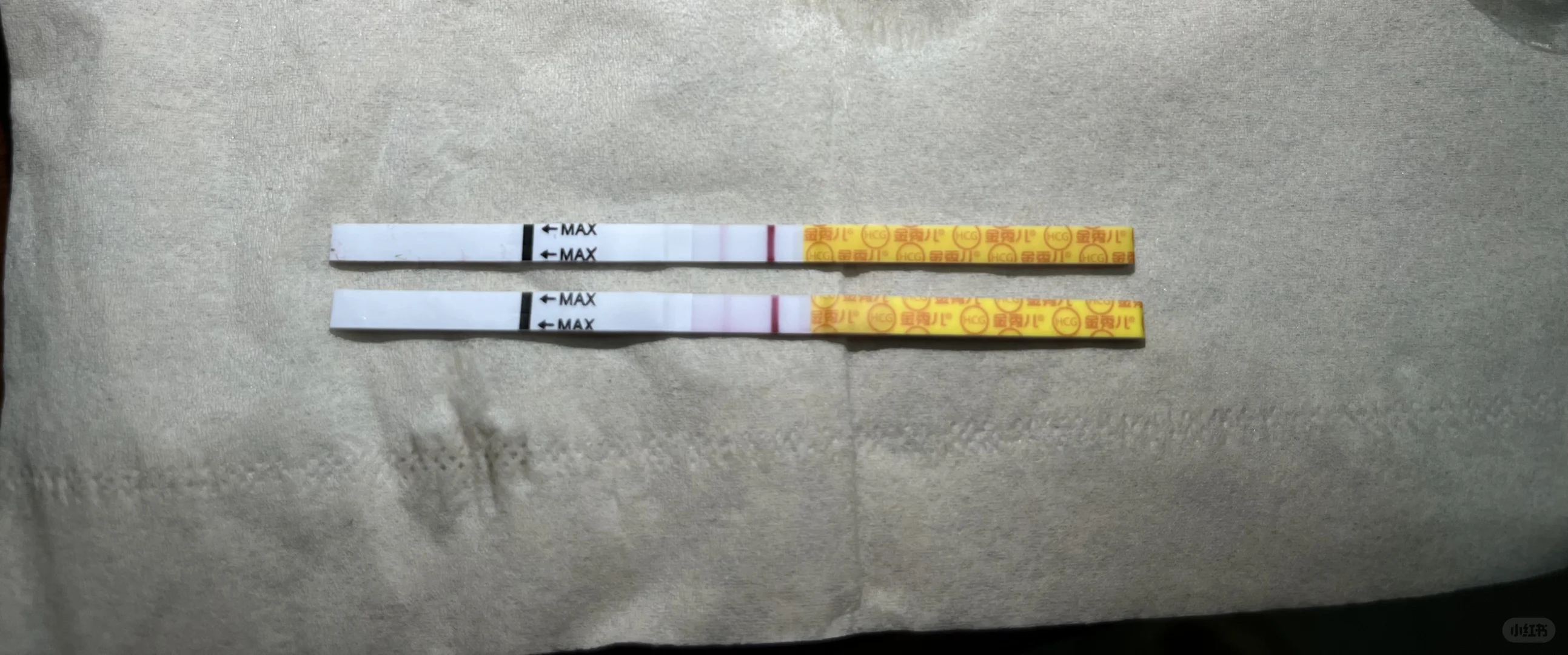 多囊姐妹的喜讯：成功自然受孕的分享