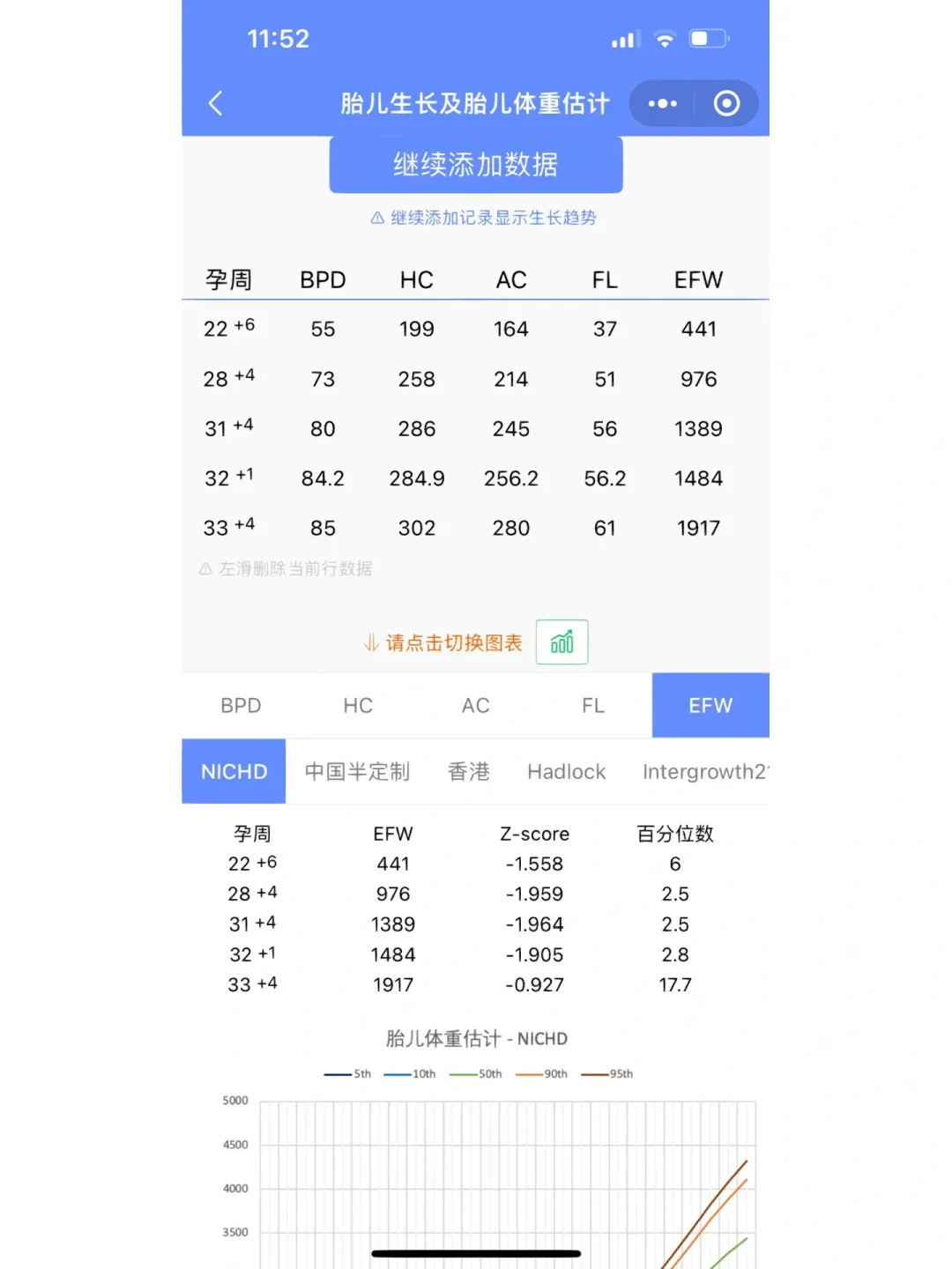 解读羊水穿刺：解析胎儿生长受限与辅助生殖的关联